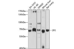 Western blot analysis of extracts of various cell lines, using ZP2 antibody (ABIN6128965, ABIN6150534, ABIN6150535 and ABIN6214263) at 1:1000 dilution. (ZP2 Antikörper  (AA 651-745))