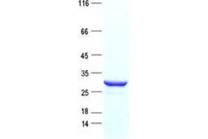 Validation with Western Blot (UCP2 Protein (His tag))