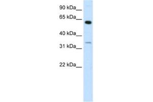 Western Blotting (WB) image for anti-Zinc Finger Protein 609 (ZNF609) antibody (ABIN2460279) (ZNF609 Antikörper)