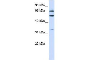 WB Suggested Anti-MED26 Antibody Titration:  0. (MED26 Antikörper  (N-Term))