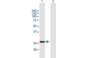 Western Blot analysis of RG9MTD1 expression in transfected 293T cell line by RG9MTD1 MaxPab polyclonal antibody.