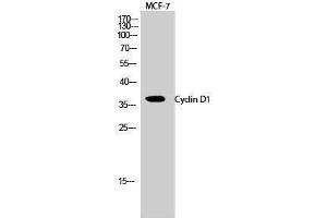Western Blotting (WB) image for anti-Cyclin D1 (CCND1) (Ser166) antibody (ABIN3174618) (Cyclin D1 Antikörper  (Ser166))