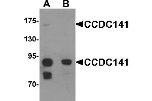 Western blot analysis of CCDC141 in SK-N-SH cell tissue lysate with CCDC141 antibody at 1 µg/mL in (A) the absence and (B) the presence of blocking peptide (CCDC141 Antikörper  (N-Term))