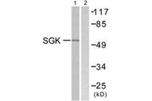 Western blot analysis of extracts from 293 cells, treated with heat shock, using SGK (Ab-78) Antibody. (SGK1 Antikörper  (AA 41-90))