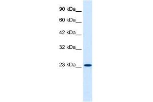 WB Suggested Anti-KCNIP2 Antibody Titration:  0. (KCNIP2 Antikörper  (N-Term))