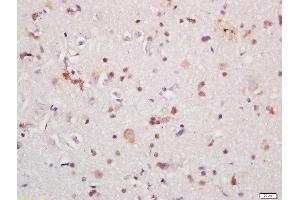Formalin-fixed and paraffin embedded rat brain labeled with Rabbit Anti-IRAK1 Polyclonal Antibody, Unconjugated (ABIN1387749) at 1:200 followed by conjugation to the secondary antibody and DAB staining