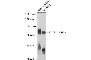Western blot analysis of extracts of various cell lines, using ENTPD1/CD39 antibody (ABIN1679729, ABIN3018088, ABIN3018089 and ABIN6220354) at 1:1000 dilution. (CD39 Antikörper  (AA 1-180))