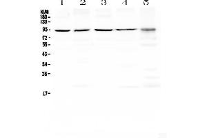 Western blot analysis of PRDM1/Blimp1 using anti-PRDM1/Blimp1 antibody . (PRDM1 Antikörper  (AA 1-230))
