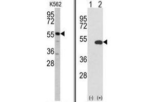 (LEFT) Western blot analysis of GPT antibody (N-term R133) in K562 cell line lysates (35 µg/lane). (ALT Antikörper  (N-Term))