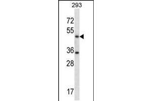 Western blot analysis in 293 cell line lysates (35ug/lane). (SHMT1 Antikörper  (N-Term))