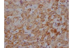 IHC image of ABIN7127865 diluted at 1:100 and staining in paraffin-embedded human liver tissue performed on a Leica BondTM system. (Rekombinanter UQCRC2 Antikörper)