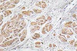 Immunohistochemical staining of paraffin-embedded human heart tissue with GNRH1 polyclonal antibody . (GNRH1 Antikörper)