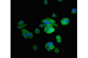 Immunofluorescent analysis of MCF-7 cells using ABIN7149238 at dilution of 1:100 and Alexa Fluor 488-congugated AffiniPure Goat Anti-Rabbit IgG(H+L) (CYP2B6 Antikörper  (AA 250-343))