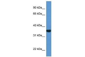 Western Blot showing NQO1 antibody used at a concentration of 1 ug/ml against 721_B Cell Lysate (NQO1 Antikörper  (C-Term))