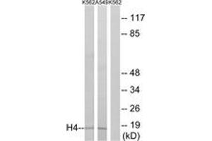 Western blot analysis of extracts from K562/A549, using Histone H4 (Ab-5) Antibody. (Histone H4 Antikörper  (AA 1-50))