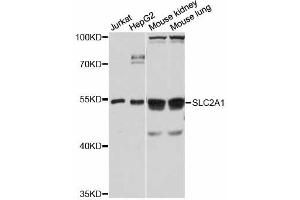 Western blot analysis of extracts of various cell lines, using SLC2A1 antibody. (GLUT1 Antikörper)