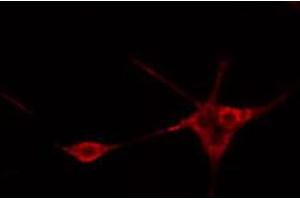 ABIN6269113 staining Hela cells by IF/ICC.