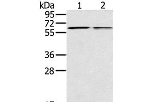 Western Blot analysis of Mouse liver and lung tissue using PTGER2 Polyclonal Antibody at dilution of 1:200 (PTGER2 Antikörper)