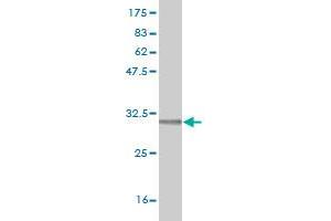 Western Blot detection against Immunogen (31. (RCE1/FACE2 Antikörper  (AA 133-182))