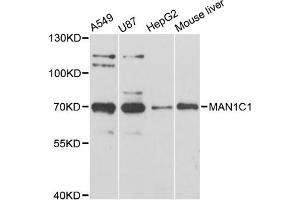Western blot analysis of extracts of various cell lines, using MAN1C1 antibody (ABIN6292826) at 1:3000 dilution. (MAN1C1 Antikörper)