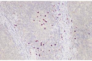 Immunohistochemistry of paraffin-embedded Human tonsil using S100A12 Polycloanl Antibody at dilution of 1:85 (S100A12 Antikörper)