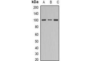 Western blot analysis of Dynamin 1 expression in NIH3T3 (A), mouse brain (B), PC12 (C) whole cell lysates. (Dynamin 1 Antikörper  (C-Term))