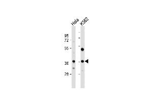 All lanes : Anti-CTDSPL Antibody (N-term) at 1:1000 dilution Lane 1: Hela whole cell lysate Lane 2: K562 whole cell lysate Lysates/proteins at 20 μg per lane.