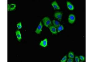 Immunofluorescent analysis of A549 cells using ABIN7150558 at dilution of 1:100 and Alexa Fluor 488-congugated AffiniPure Goat Anti-Rabbit IgG(H+L) (DNAJC4 Antikörper  (AA 1-155))