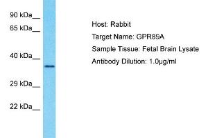 Host: Rabbit Target Name: GPR89A Sample Type: Fetal Brain lysates Antibody Dilution: 1. (GPR89A Antikörper  (C-Term))