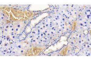 Detection of HB in Rat Adrenal gland Tissue using Polyclonal Antibody to Hemoglobin (HB)