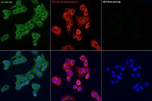 Immunofluorescence analysis of HepG2 cells , using ACLY antibody (ABIN7265716) as the primary antibody at dilution of 1:100.