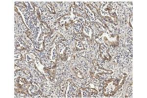 IHC analysis of Methylmalonyl Coenzyme A using anti-Methylmalonyl Coenzyme A antibody (ABIN7603112). (MUT Antikörper  (N-Term))