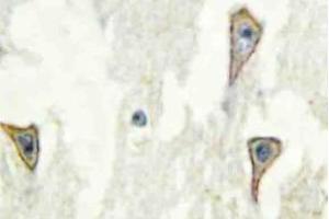 Immunohistochemistry (IHC) analyzes of A Cyclase I antibosy in paraffin-embedded human brain tissue. (ADCY1 Antikörper)
