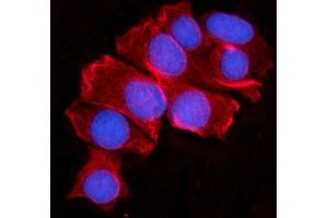IF analysis of MOV10 using anti-MOV10 antibody (ABIN7600236). (MOV10 Antikörper  (AA 167-772))
