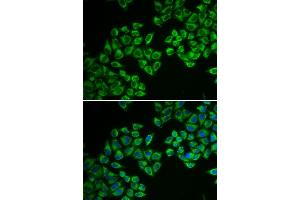 Immunofluorescence analysis of A549 cell using HMGCR antibody. (HMGCR Antikörper)