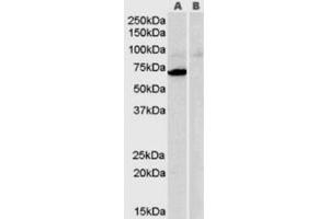 Western Blotting (WB) image for anti-Monoamine Oxidase A (MAOA) (Internal Region) antibody (ABIN2465953) (Monoamine Oxidase A Antikörper  (Internal Region))