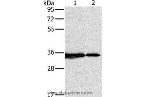 Western blot analysis of 231 and Jurkat cell, using NDUFAF1 Polyclonal Antibody at dilution of 1:500 (NDUFAF1 Antikörper)