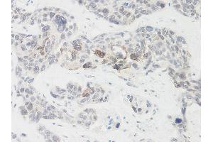 Immunohistochemistry (IHC) image for anti-Nephroblastoma Overexpressed (NOV) antibody (ABIN2474328)