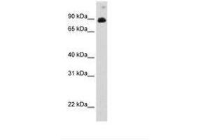 Image no. 1 for anti-Signal Transducer and Activator of Transcription 6, Interleukin-4 Induced (STAT6) (C-Term) antibody (ABIN6736291)