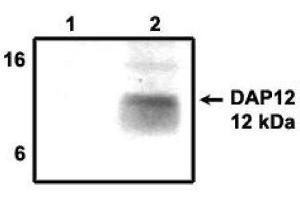 Image no. 1 for anti-TYRO Protein tyrosine Kinase Binding Protein (TYROBP) antibody (ABIN265057) (TYROBP Antikörper)