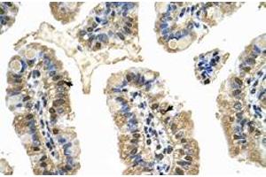 Immunohistochemical staining (Formalin-fixed paraffin-embedded sections) of human intestine with MCM8 polyclonal antibody  at 4-8 ug/mL working concentration. (MCM8 Antikörper  (C-Term))