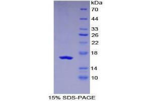 SDS-PAGE (SDS) image for Leukemia Inhibitory Factor Receptor alpha (LIFR) (AA 45-184) protein (His tag) (ABIN1980767)