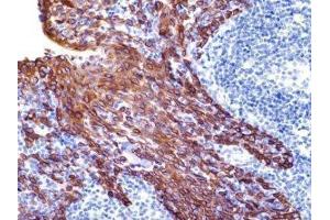 Immunohistochemistry (IHC) image for anti-Keratin 19 (KRT19) (C-Term) antibody (ABIN870577) (Cytokeratin 19 Antikörper  (C-Term))