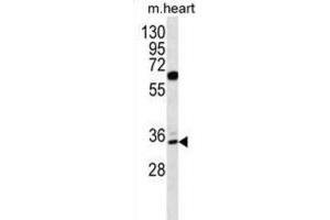 Western Blotting (WB) image for anti-Zinc Finger Protein 146 (ZNF146) antibody (ABIN2996706) (ZNF146 Antikörper)