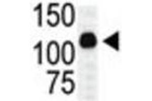 Western Blotting (WB) image for anti-Mitogen-Activated Protein Kinase Kinase Kinase 10 (MAP3K10) antibody (ABIN3003575) (MAP3K10 Antikörper)