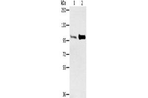 Western Blotting (WB) image for anti-Actinin, alpha 2 (ACTN2) antibody (ABIN2427123) (ACTN2 Antikörper)