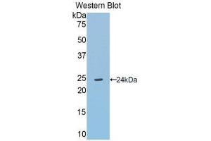 Western Blotting (WB) image for anti-Angiotensinogen (serpin Peptidase Inhibitor, Clade A, Member 8) (AGT) (AA 155-355) antibody (ABIN1857946) (AGT Antikörper  (AA 155-355))