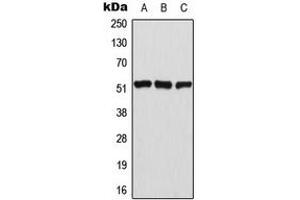 Western blot analysis of ATF2 (pT69) expression in HeLa (A), NIH3T3 (B), PC12 (C) whole cell lysates.