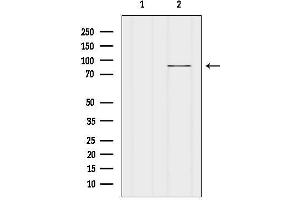 anti-FAST Kinase Domains 5 (FASTKD5) (Internal Region) antibody
