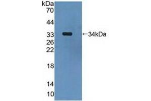 Detection of Recombinant MAP2K6, Human using Polyclonal Antibody to Mitogen Activated Protein Kinase Kinase 6 (MAP2K6) (MAP2K6 Antikörper  (AA 46-306))